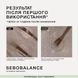 Triology Sebobalance &mdash; балансирующая сыворотка для кожи головы, склонной к жирности, 5&times;5 мл 332444 фото 5